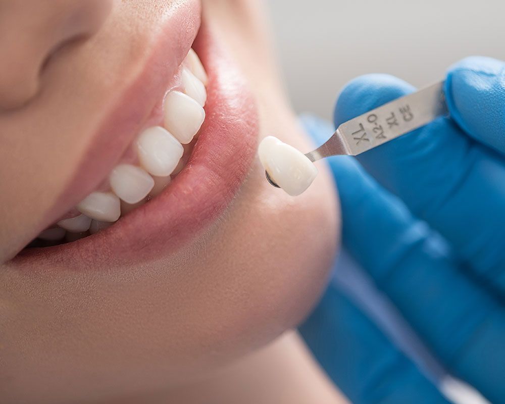 veeners-2_892_large_cnLrkgteel